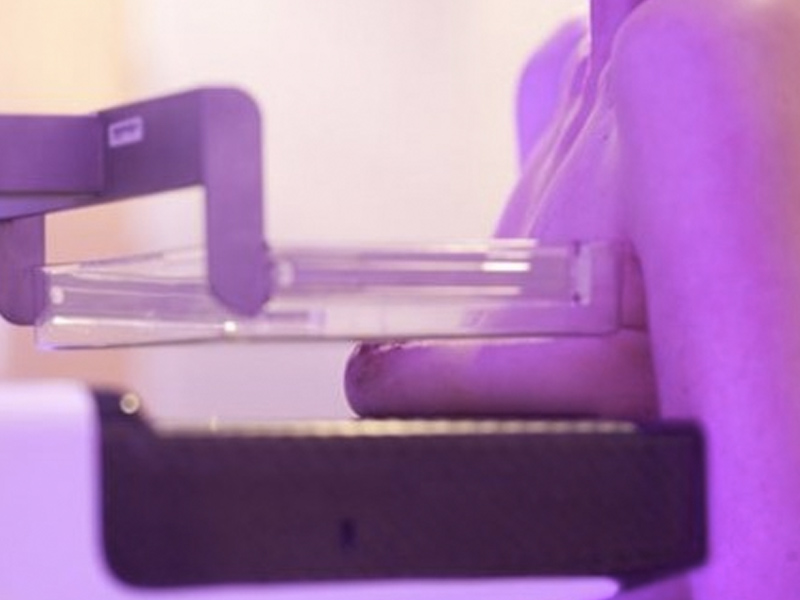 Avances en investigación de cánceres agresivos de mama en Albacete - imagen 1