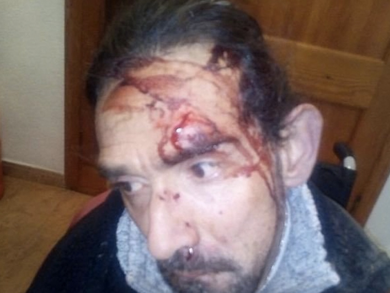 La brutal paliza a un paralítico cerebral bajo la sombra de las bandas latinas - imagen 1