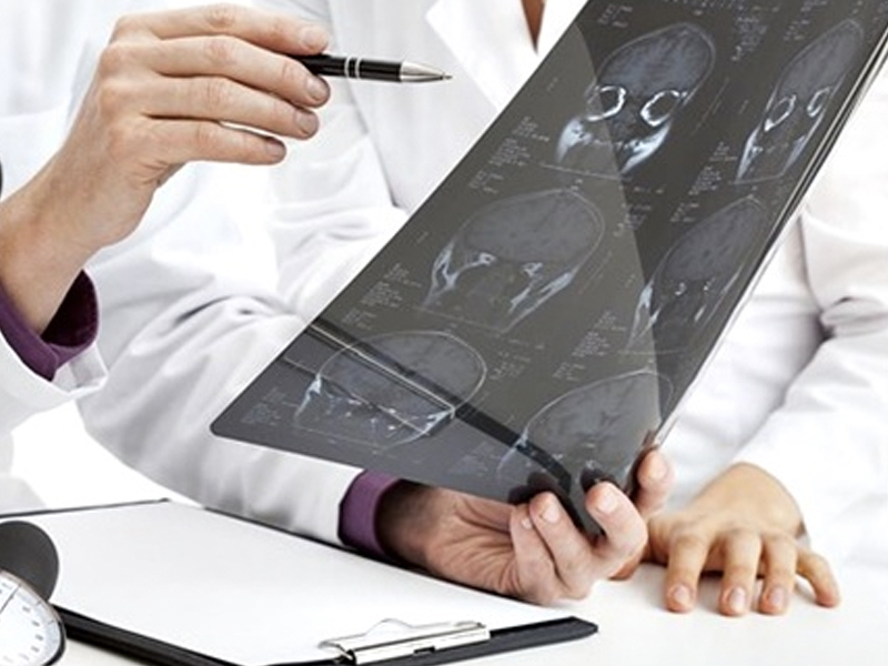 Albacete, clave en la actualización del Código Ictus del Servicio de Salud de Castilla-La Mancha - imagen 1