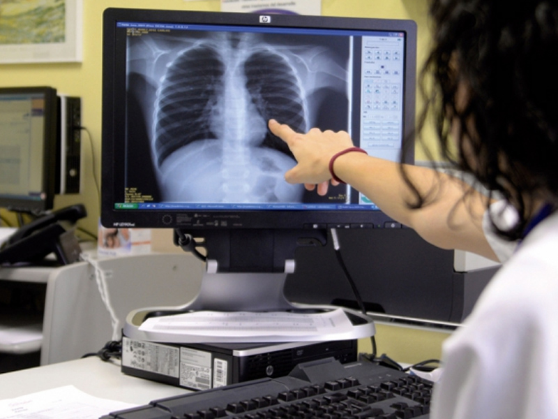 El 5 por ciento de los conquenses padece algún tipo de asma - imagen 1